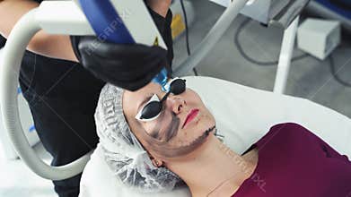 Close-up cosmetologist makes carbon peeling procedure, laser flash cleans skin of patient face