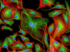 Fluorescence Microscope image of human cells undergoing mitosis