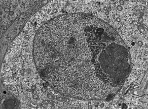 Sex vesicle, TEM