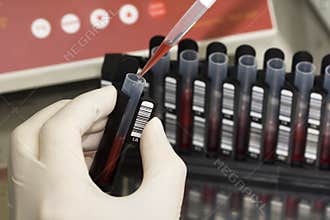 Work with blood