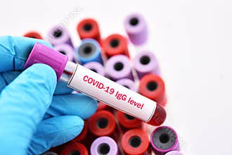 Blood sample for COVID-19 antibody level test