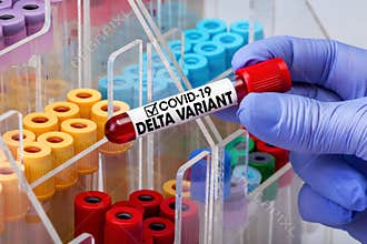 Doctor epidemiologist holding blood tube for test detection of virus Covid-19 Delta Variant with positive result
