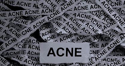Strips of newspaper with the words Acne typed on them. Black and white.