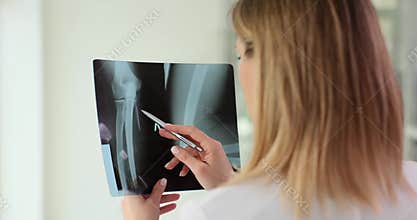 Female traumatologist examines x-rays of elbow and arm bones