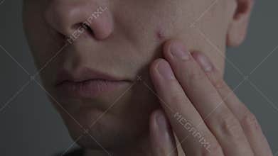 Acne and skin problem. Close up of man touching pimple on face, male skincare, dermatology concept, real life lifestyle.
