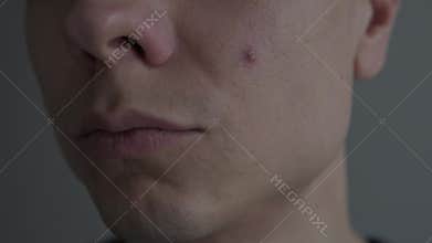 Single pimple on male face, extreme macro skin texture, acne and blemish problem, realistic skincare concept.