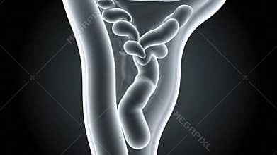 3D Animation of Medical Tibia and Fibula with Defect on Dark Background for Medical Visualization and Health Education