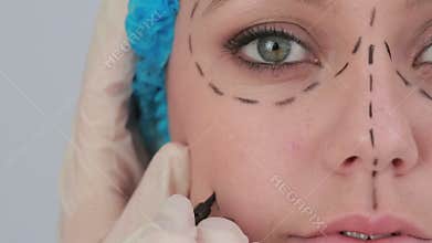 Video of woman with hair net and black dashes lines for a face lift