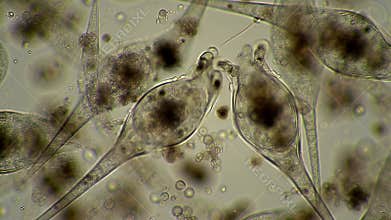 Microscopic View of Vorticella Organisms in Motion Transparent Background Biological Study of Ciliated Protozoa in Liquid