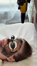 Young woman getting carbon laser facial at beauty clinic. Professional skincare