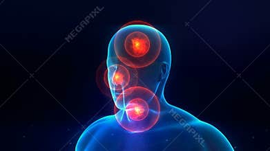 Human phantom with a pains