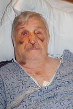 Senior man hospital selfie