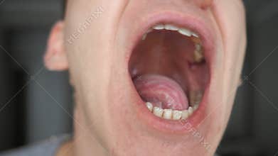 Man shows his mouth, tongue and teeth.