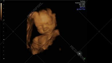 Sweet Baby Girl enjoying her peaceful Life in Mothers Womb