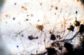 Microscopic view of aspergillus