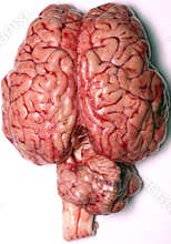 Real Brain