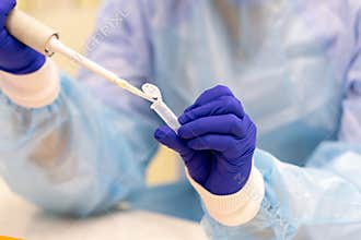 Laboratory assistant with a pipette in his hands for blood testing