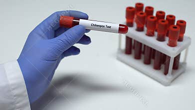 Chickenpox, doctor showing blood sample in tube, lab research, health checkup