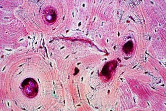 Histology of human compact bone tissue under microscope view for