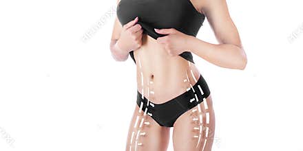 Beautiful female body with plastic arrows. Isolated on white. slimming concept.