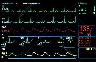 Medical monitor