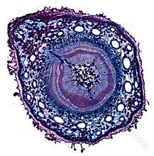Microscopic cross section cut of a plant stem under the microscope