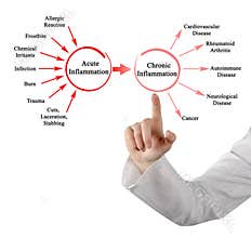 Acute and Chronic Inflammation