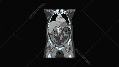 Medical MRI images screen, CT or CAT scanner