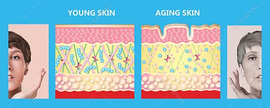 Younger skin and aging skin. elastin and collagen.