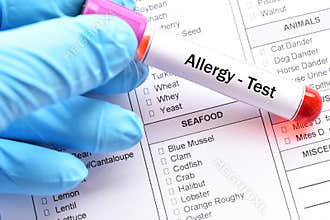 Food allergy test