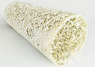 Cross section of an advanced osteoporosis -high details - Stage 4 - 3d rendering