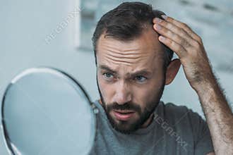 upset middle aged man with alopecia looking at mirror hair loss