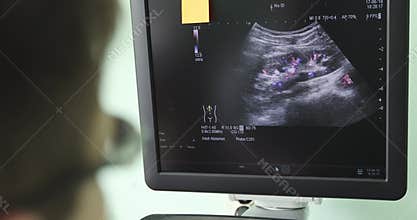 A male doctor looks at the ultrasound screen in a modern clinic.