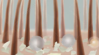 Scalp treatment. Dandruff on hair. Close-up.