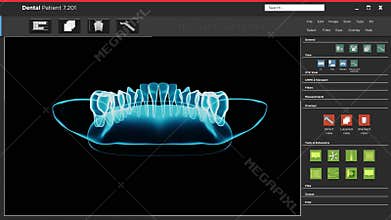 Interface of software app user interface with dental xray scan ,