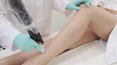 Laser hair removal procedure for legs. Cosmetology and hair removal. Body care.