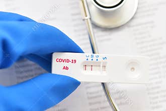 COVID-19 IgM antibody positive