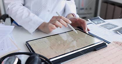 A cardiologist examines a cardiogram on a tablet screen