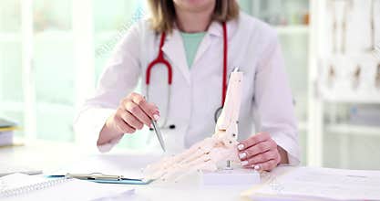 Doctor explains operation of foot on bone model