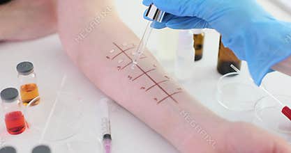 Allergen skin test procedure and detailed process