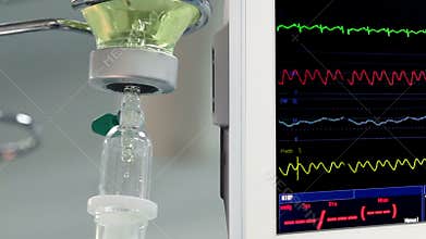 Surgeons in operation room with ECG monitor
