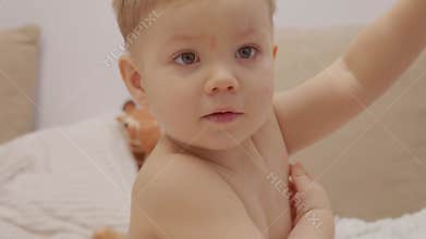 Child with early stage chickenpox showing itching on skin