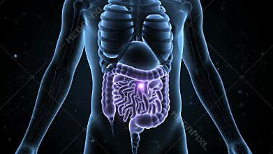 Medical Animation of Human Colon with Polyp in a Male Torso Silhouette with Glowing Purple Highlight Against Dark Blue