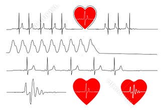 Heartbeat Pulse Electrocardiogram Illustrations