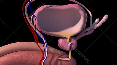 Benign prostatic hyperplasia