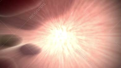 Irritable bowel condition