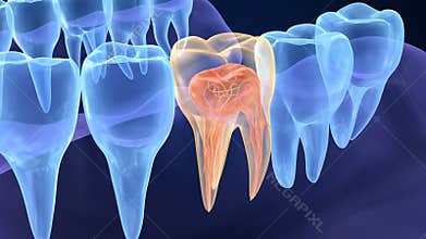 Transparent teeth. Endodontics inner structure of molar teeth