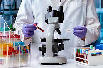 Microbiologist who is working with blood tube test in the microbiology laboratory