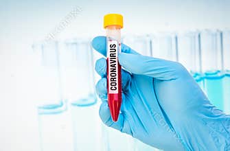 Test-tube with positive blood test on CORONAVIRUS