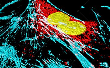 Fibroblast cells